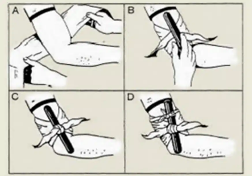 bron crises-medicine.com geimproviseerd windwill tourniquet